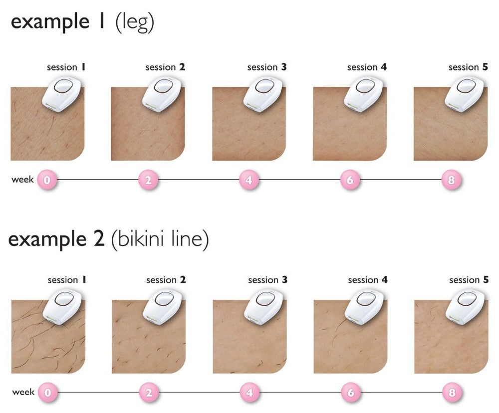 Popular hair removal device laser hair removal device IPL household women's shaving strong pulse hair removal device