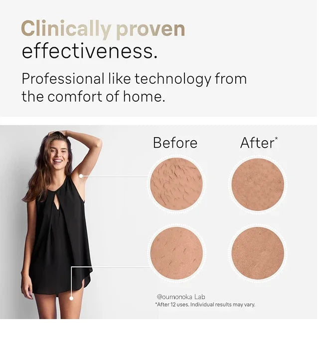 IPL Hair Removal Device 999999 Flashes  Permanent Epilator Body Treament Home Use for Women Men Facial Shaver Cutting Machine