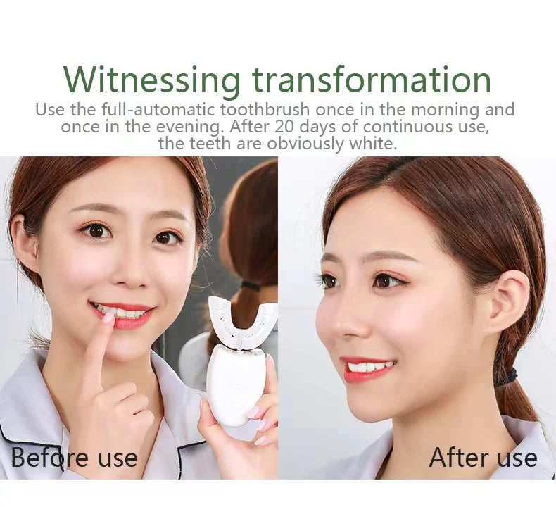 Sonic Automatic Electric Toothbrush For AdultUShaped 360 Degree Toothbrush USB RechargeableTeeth Cleaning & Whitening Brush