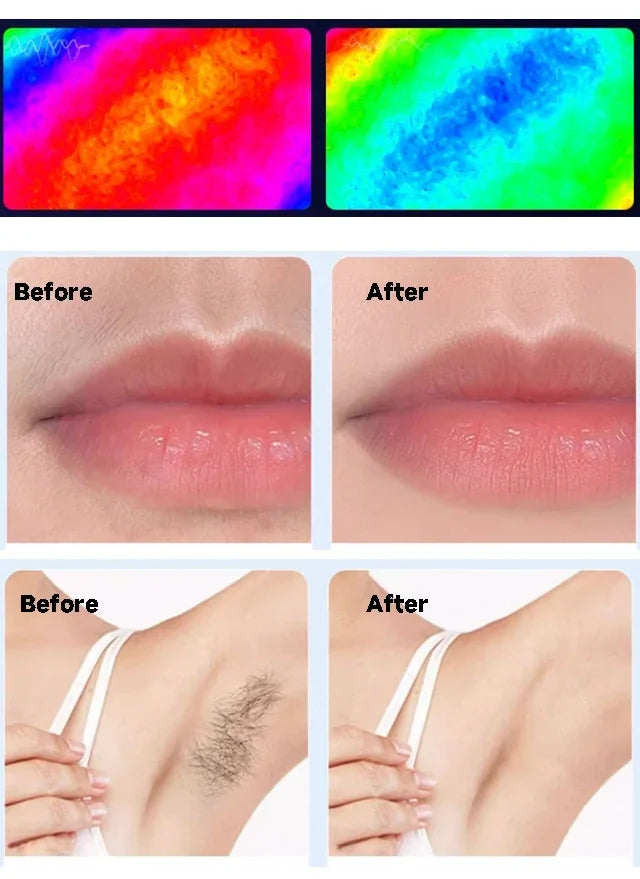 IPL Hair Removal Device 999999 Flashes  Permanent Epilator Body Treament Home Use for Women Men Facial Shaver Cutting Machine