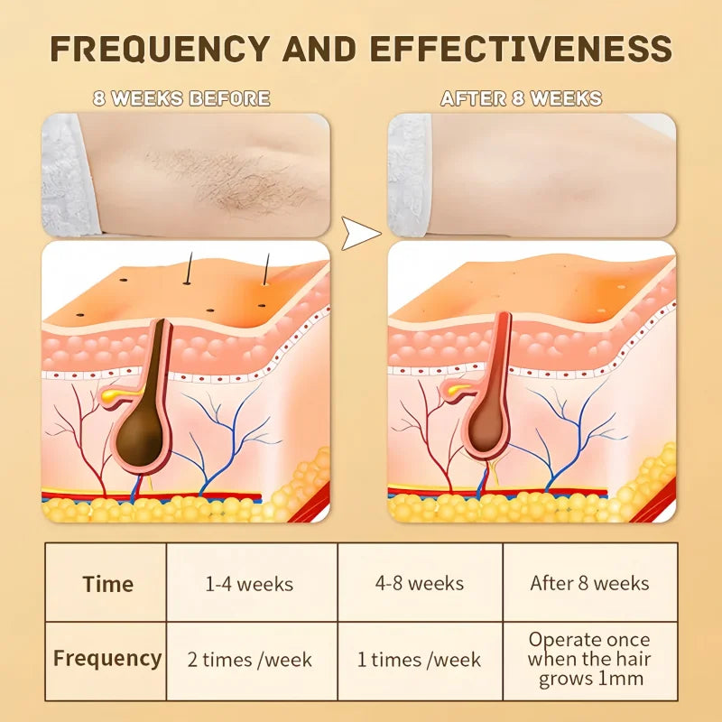 Swoson Professional Permanent Laser Depilator Body Bikini IPL Hair Removal Handset Home Use For Women and Men