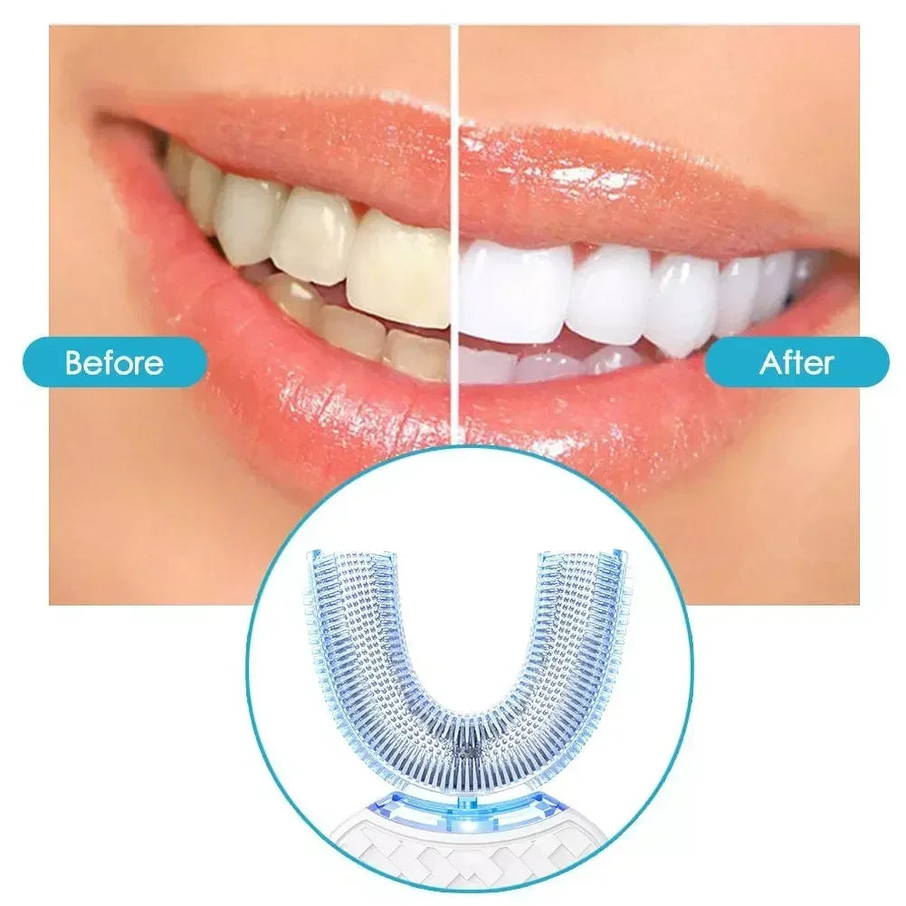 Ultrasonic Electric Toothbrush Adult,Automatic Toothbrush U-Shape Full Mouth 360° Clean Teeth Whitening IPX7 Waterproof