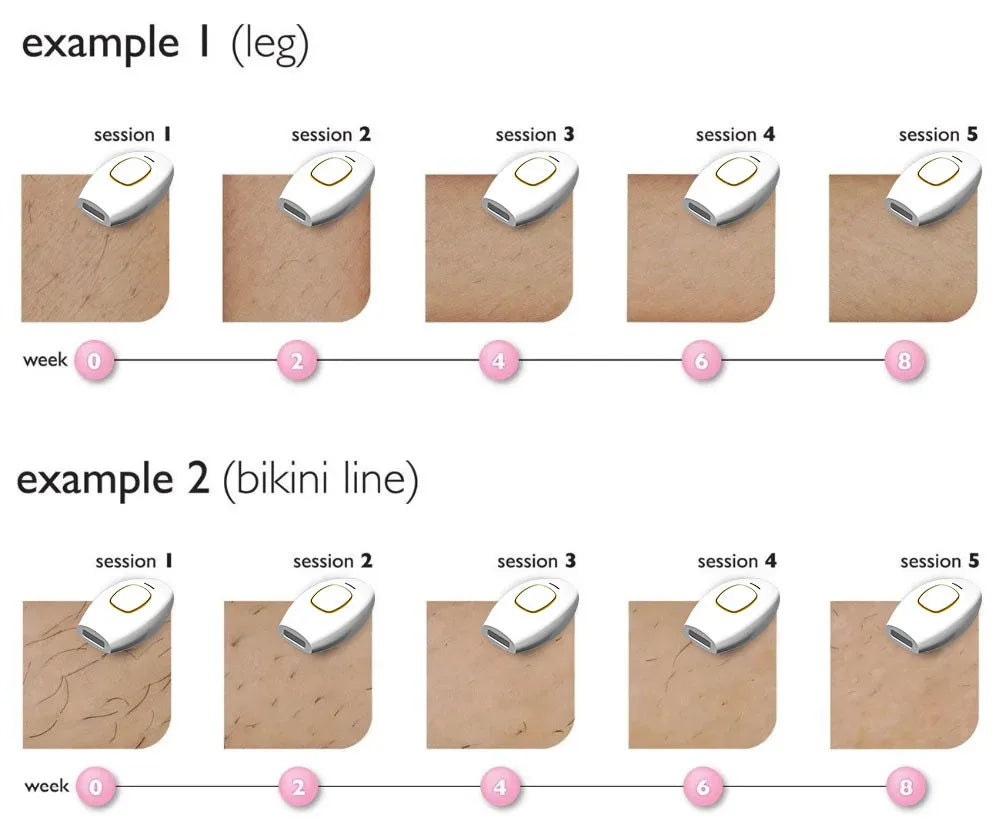 Permanently Home Use Mini Handheld 999999 Flashes IPL Laser Hair Removal Device Painless Personal Care for Men and Women 881