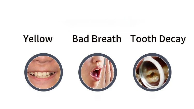 360° Ultrasonic Electric Toothbrush U Shaped for Adults Sonic Vibrations Tooth Brush with Charging Base Blue LED Light Whitening